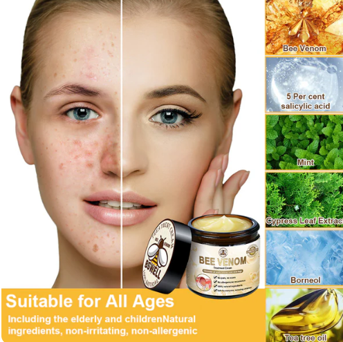 CREMA PARA ARTICULACION Y BERRUGAS VENENO DE ABEJAS