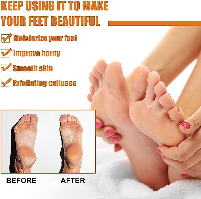 GFOUK™ Spray para eliminar callos en los pies
