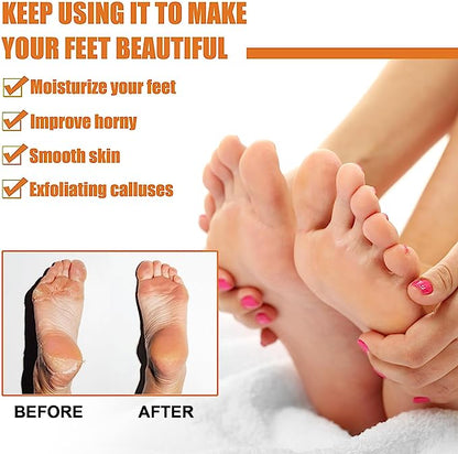 GFOUK™ Spray para eliminar callos en los pies