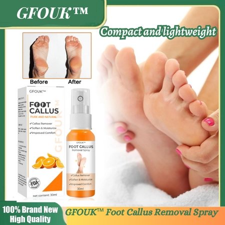 GFOUK™ Spray para eliminar callos en los pies