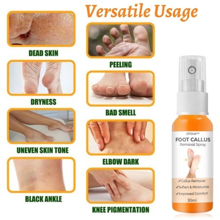 GFOUK™ Spray para eliminar callos en los pies